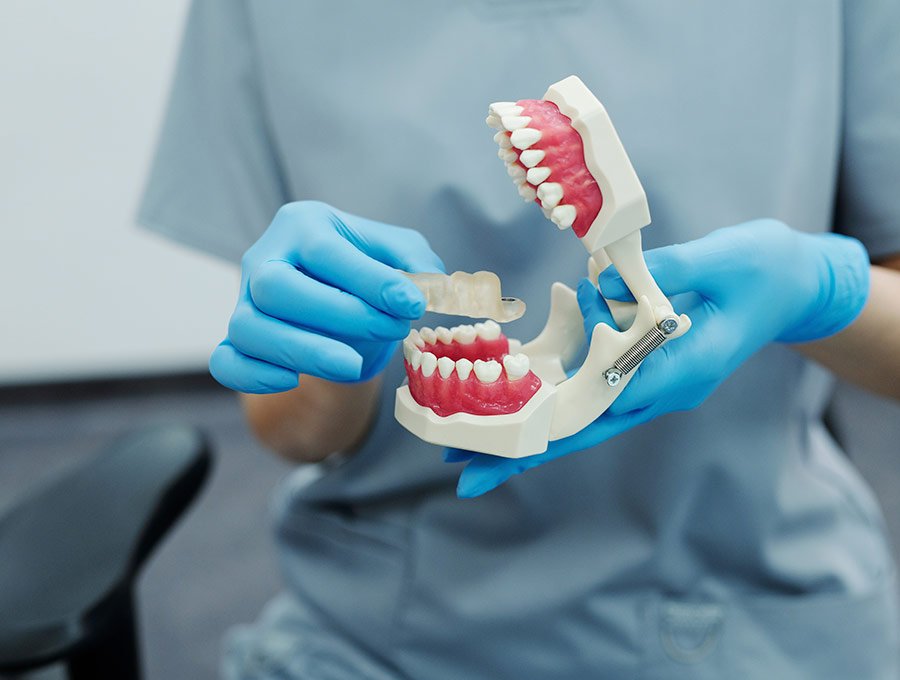 Comprueba que el puente dental encaja bien en la dentadura 3D del paciente.