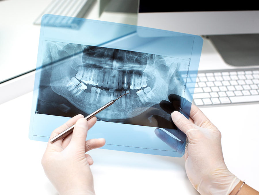 Una dentista revisa a fondo la radiografía intraoral de una paciente.