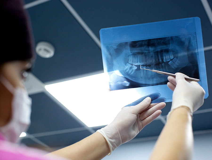 Dentista revisa a fondo una radiografía dental.