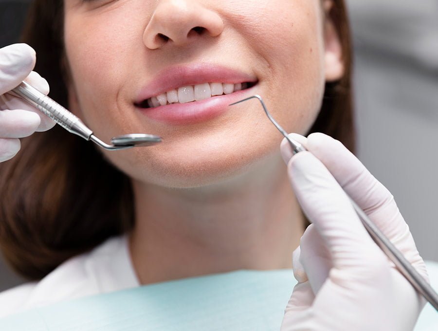 El dentista utiliza una cureta dental para limpiar el sarro entre los dientes.