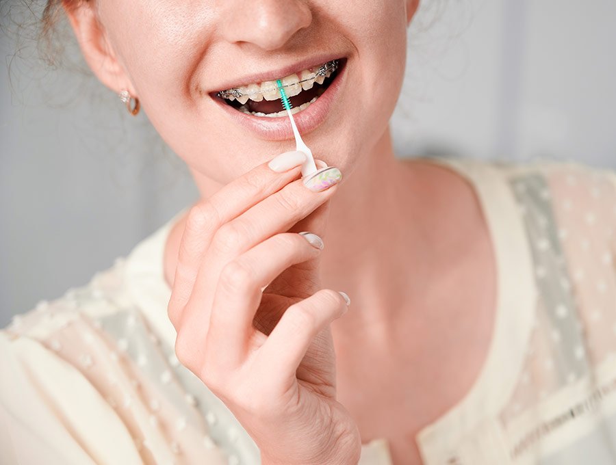 Mujer joven con ortodoncia se limpia bien los huecos con cepillo interdental.
