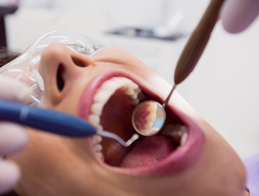 Dentista revisa bien los dientes de una paciente en busca de caries, tras el blanqueamiento.