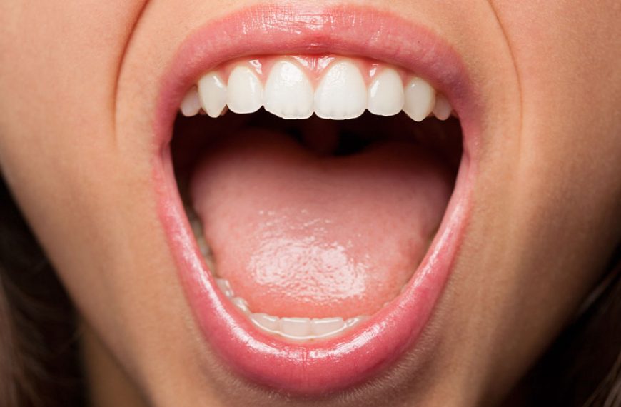 Mujer con la boca abierta para mostrar sus dientes.