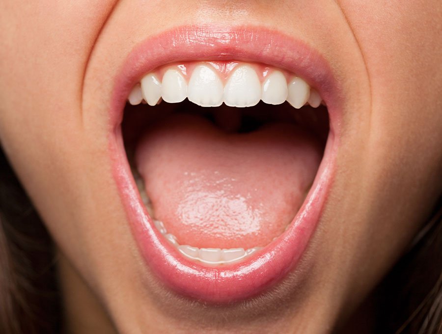 Mujer con la boca abierta para mostrar sus dientes.