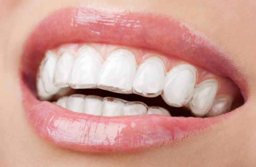Consejos para cepillar los dientes de un niño de año y medio: garantiza una sonrisa saludable